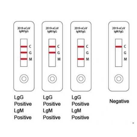 SARS-CoV-2 (Covid-19): Diagnosis by IgG/IgM Rapid Test