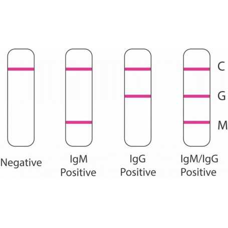 SARS-CoV-2 (Covid-19): Diagnosis by IgG/IgM Rapid Test