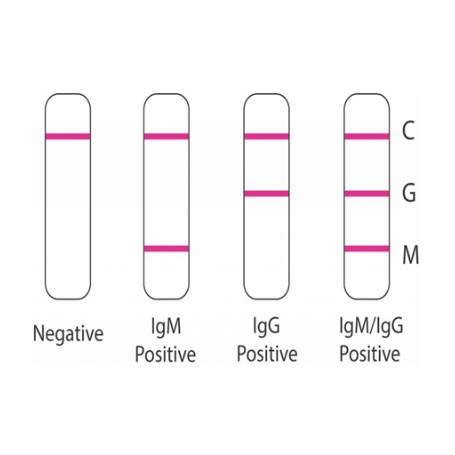 SARS-CoV-2 (Covid-19): Diagnosis by IgG/IgM Rapid Test