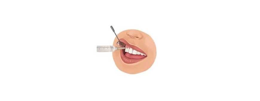 Dental anesthesia