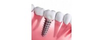 Dental screws and implants